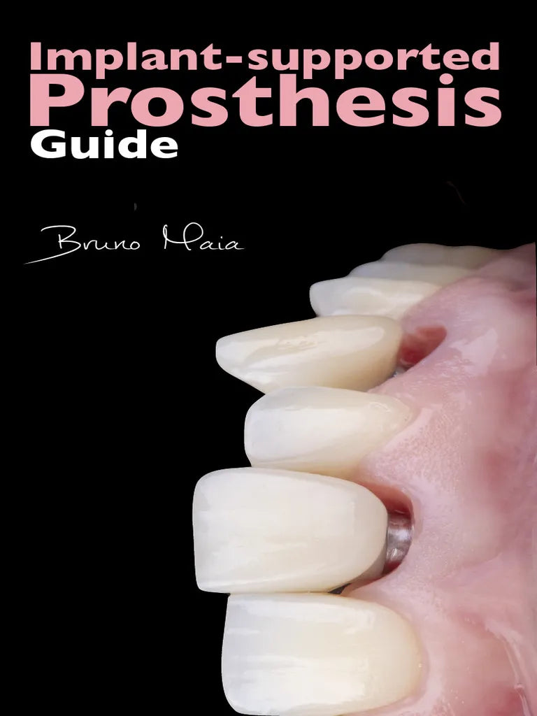 Implant Supported Prosthesis Guide