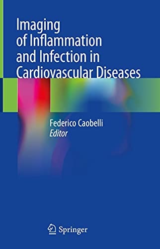 Imaging of Inflammation and Infection in Cardiovascular Diseases