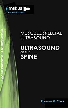 Ultrasound of the Spine, 2nd Edition