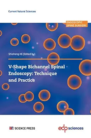 V-shape Bichannel Spinal Endoscopy: Technique and Practice