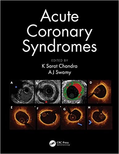 Acute Coronary Syndromes