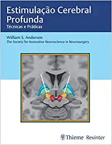 Estimulação Cerebral Profunda: Técnicas e Práticas