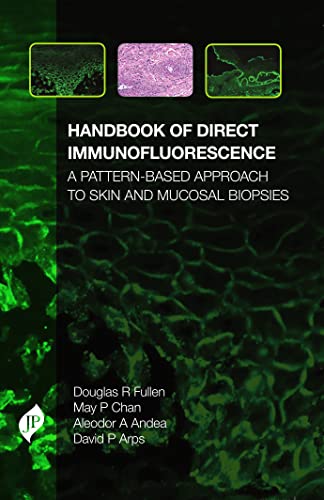 Handbook of Direct Immunofluorescence