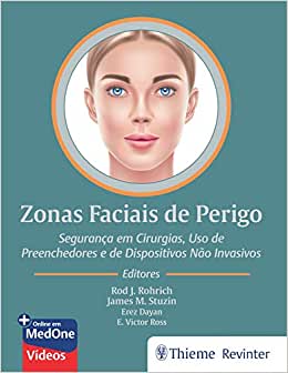Zonas Faciais de Perigo: Seguranças em Cirurgias, Uso de Preenchedores e de Dispositivos Não Invasivos