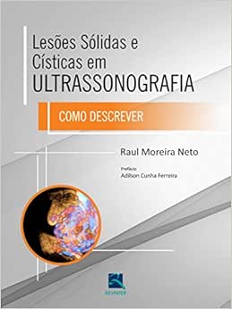 Lesões Solidas e Cisticas em Ultrassonografia: Como descrever, 1st Edition