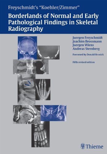 Koehler/Zimmer’s Borderlands of Normal and Early Pathological Findings in Skeletal Radiography, 5th edition