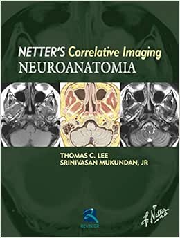 Neuroanatomia: Netter’s Currelative Imaging, 1st Edition