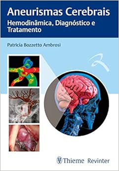 Aneurismas Cerebrais: Hemodinâmica, Diagnóstico e Tratamento, 1st Edition