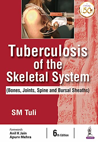 Tuberculosis Of The Skeletal System (Bones, Joints, Spine And Bursal Sheaths)