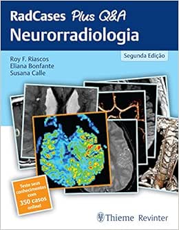 RadCases Plus Q&A Neurorradiologia, 2nd Edition