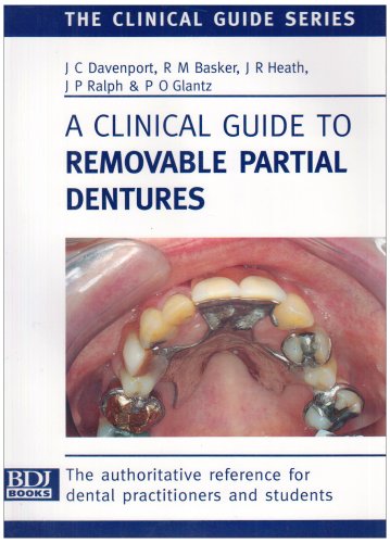 A clinical guide to removable partial dentures