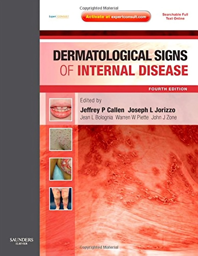Dermatological Signs of Internal Disease, 4th Edition