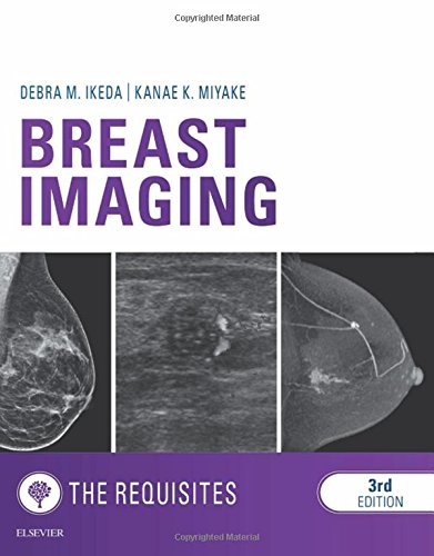 Breast Imaging: The Requisites, 3rd Edition (Requisites in Radiology)