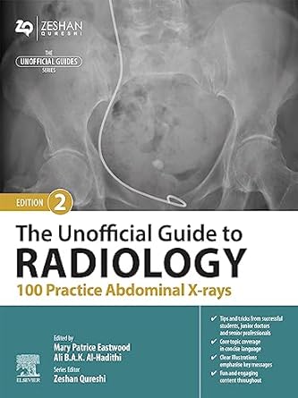 The Unofficial Guide to Radiology: 100 Practice Abdominal X-rays, 2nd edition