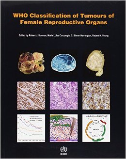 WHO Classification of Tumours of the Female Reproductive Organs (IARC WHO Classification of Tumours) (Retail PDF)