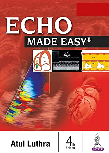 ECHO Made Easy, 4th Edition