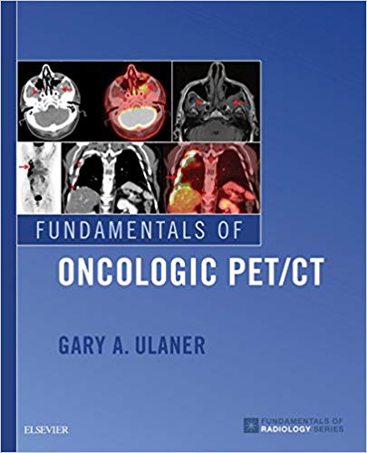 Fundamentals of Oncologic PET/CT (Fundamentals of Radiology) (PDF)