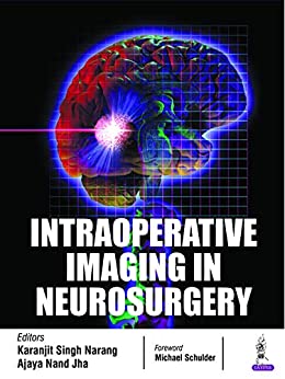 Intraoperative Imaging in Neurosurgery