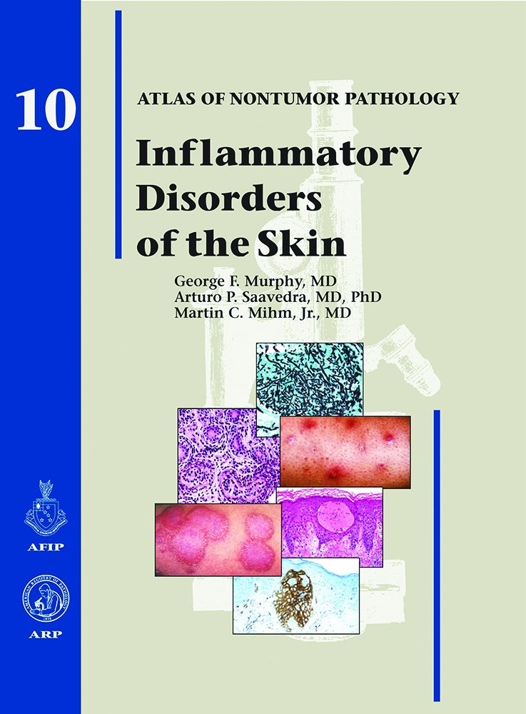 Inflammatory Disorders of the Skin