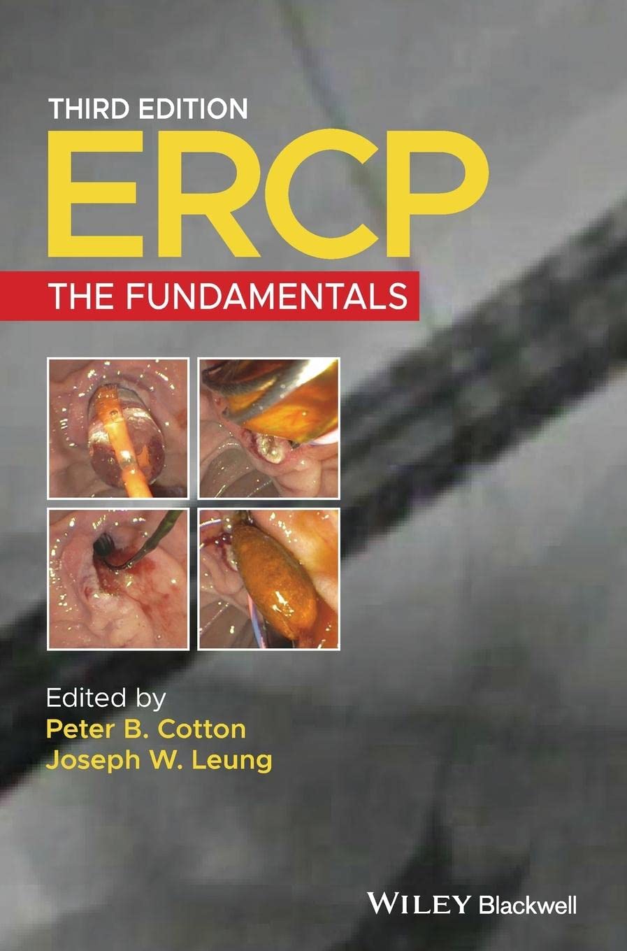 ERCP: The Fundamentals, 3e