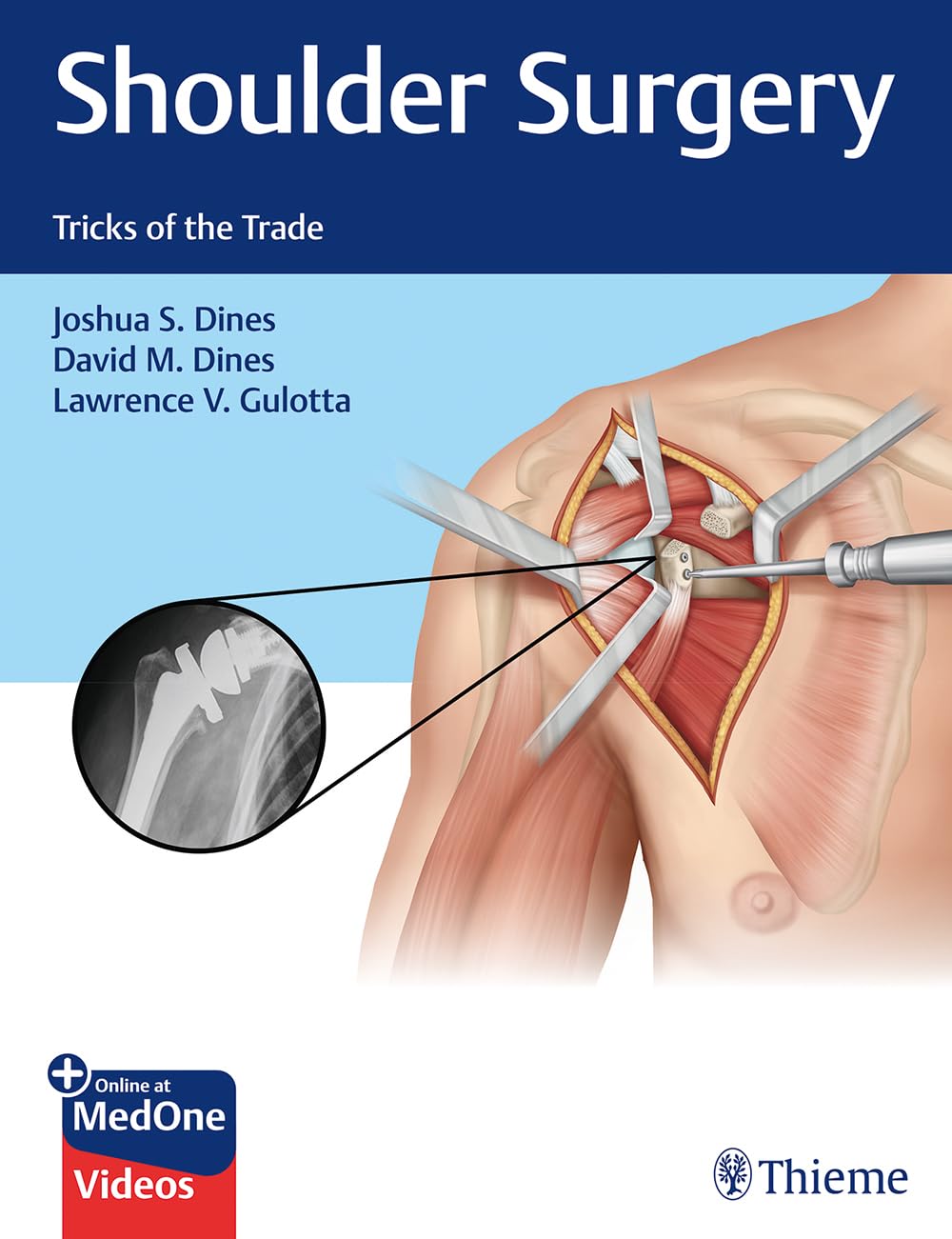 Shoulder Surgery: Tricks of the Trade (PDF)
