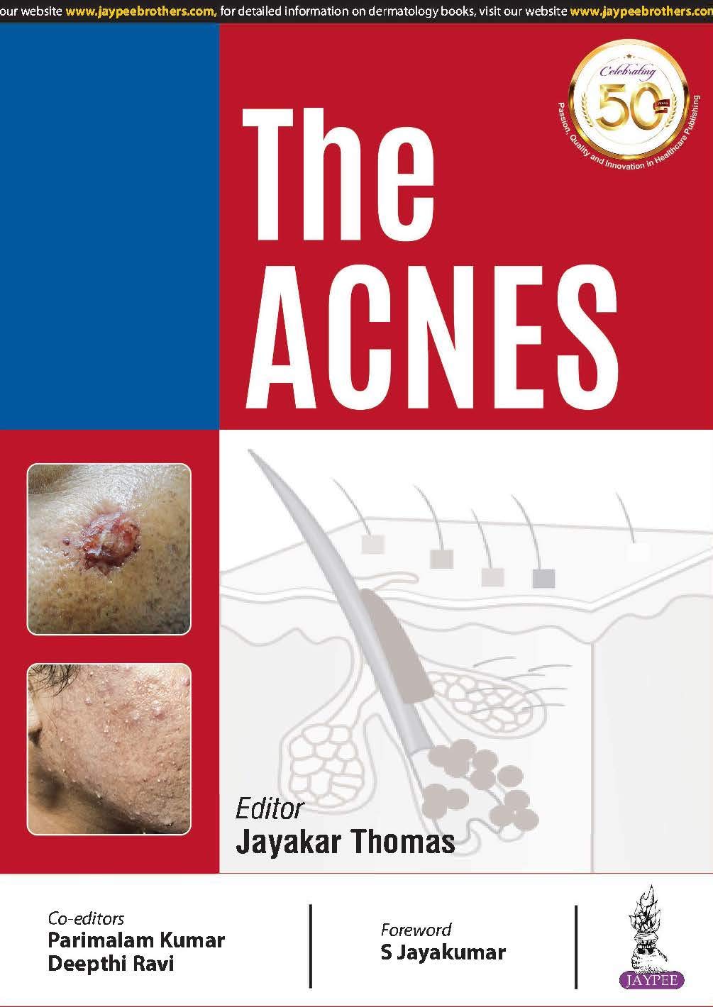 The Acnes