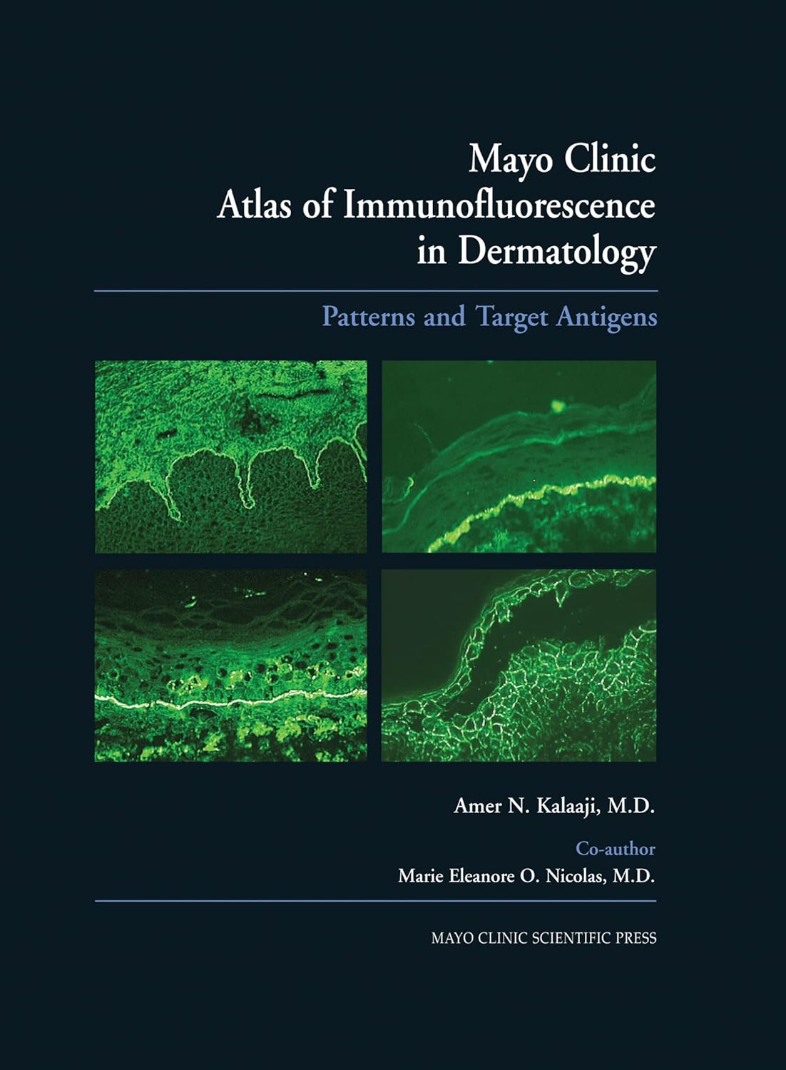 Mayo Clinic Atlas of Immunofluorescence in Dermatology: Patterns and Target Antigens 1st Edition