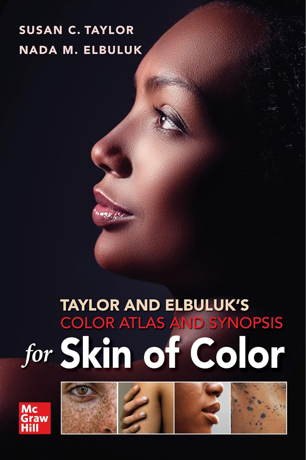 Taylor and Elbuluk’s Color Atlas and Synopsis for Skin of Color