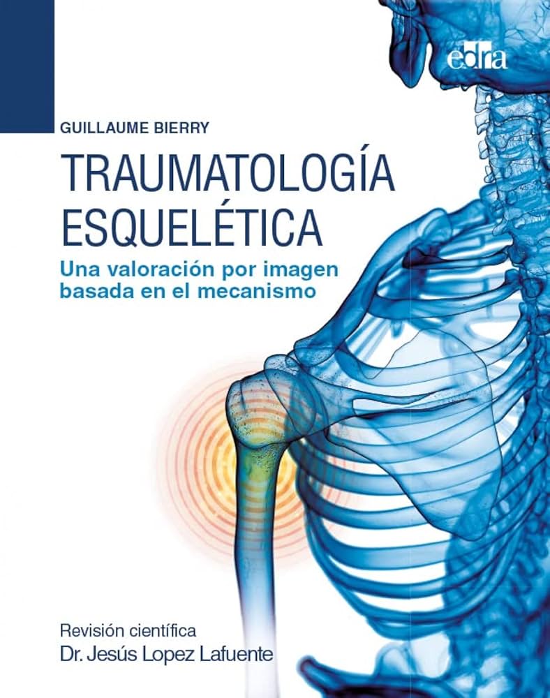 Traumatología esquelética Una valoración por imagen basada en el mecanismo