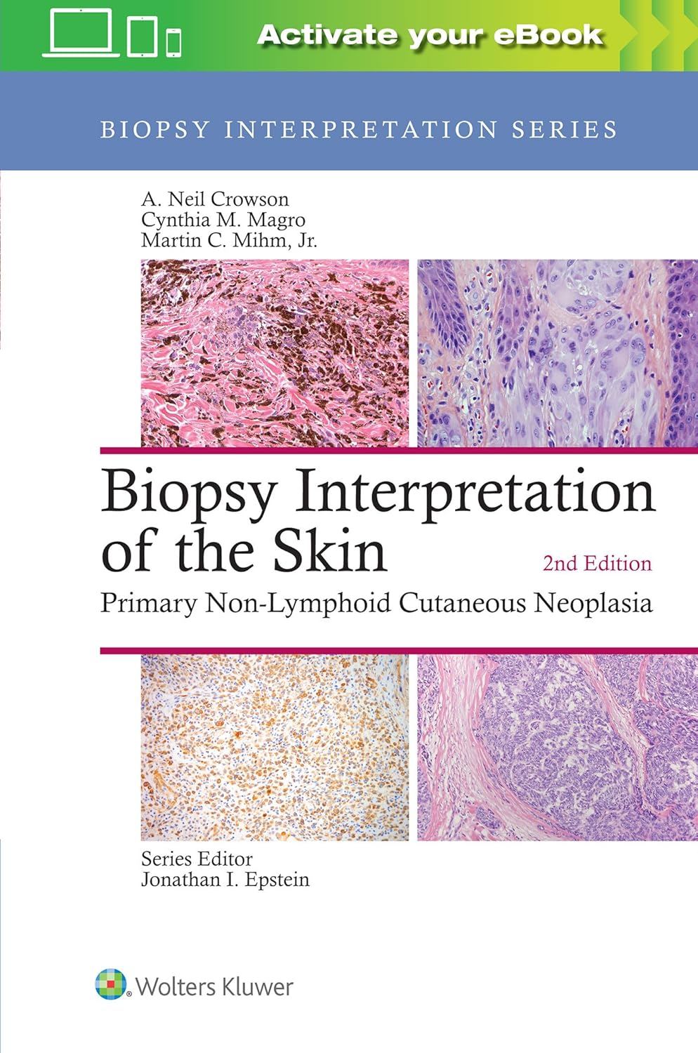 Biopsy Interpretation of the Skin: Primary Non-Lymphoid Neoplasms of the Skin 2nd Edition