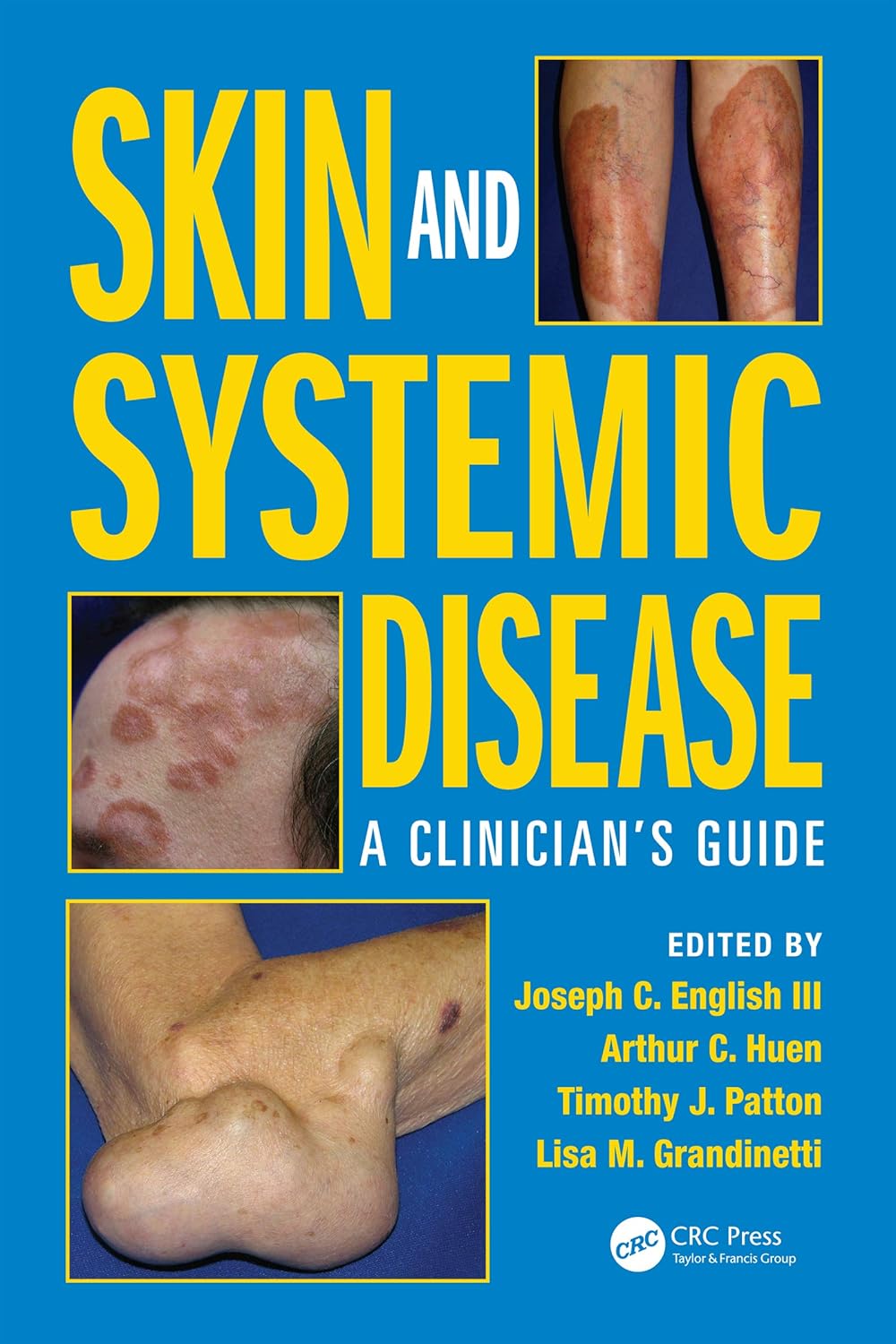 Skin and Systemic Disease: A Clinician’s Guide 1st Edition