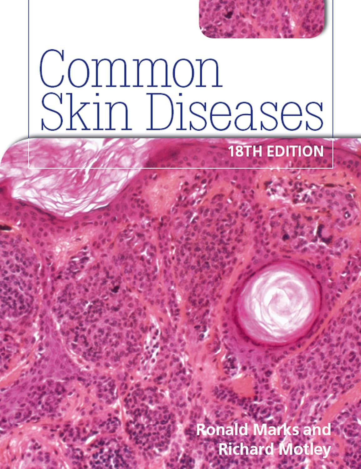 Common Skin Diseases, 18th Edition