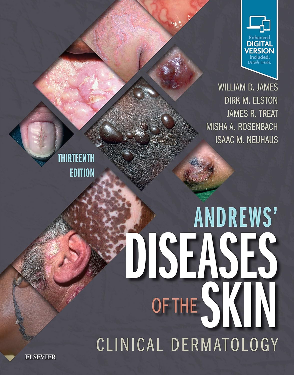 Andrews’ Diseases of the Skin: Clinical Dermatology, 13th Edition