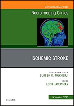 Ischemic Stroke, An Issue of Neuroimaging Clinics of North America (Volume 28-4) (The Clinics: Radiology, Volume 28-4)