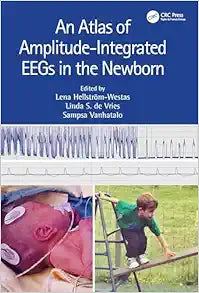 An Atlas of Amplitude-Integrated EEGs in the Newborn, 3rd edition