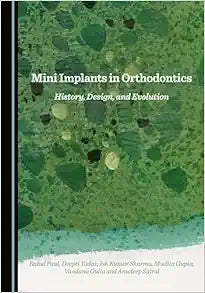 Mini Implants in Orthodontics: History, Design, and Evolution