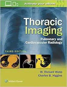Thoracic Imaging: Pulmonary and Cardiovascular Radiology, 3rd edition