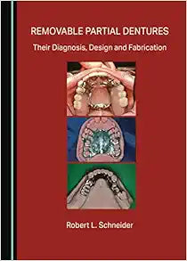 Removable Partial Dentures: Their Diagnosis, Design and Fabrication