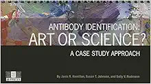 Antibody Identification: Art or Science? a Case Study Approach