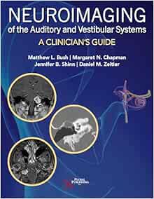 Neuroimaging of the Auditory and Vestibular Systems: A Clinician’s Guide