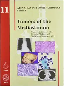 Tumors of the Mediastinum (AFIP Atlas of Tumor Pathology, Series 4, Fascicle 11)