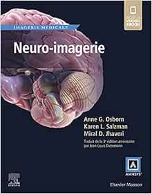 Neuro-imagerie – Collection Imagerie Médicale Amirsys – Osborn