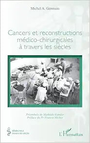 Cancers et reconstructions médico-chirurgicales à travers les siècles (French Edition)