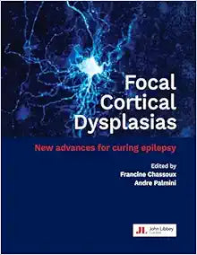 Focal Cortical Dysplasias: New advances for curing epilepsy