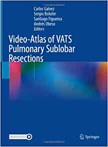Video-Atlas of VATS Pulmonary Sublobar Resections