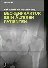 Beckenfraktur beim älteren Patienten (German Edition)