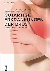 Gutartige Erkrankungen der Brust: Ein Leitfaden für die Praxis (German Edition)