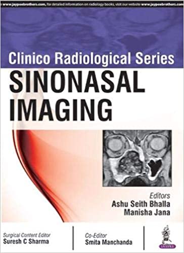 Sinonasal Imaging (Clinico Radiological Series)