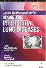 Clinico Radiological Series: Imaging of Interstitial Lung Diseases, 2nd edition