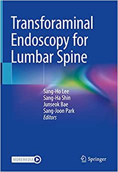 Transforaminal Endoscopy for Lumbar Spine